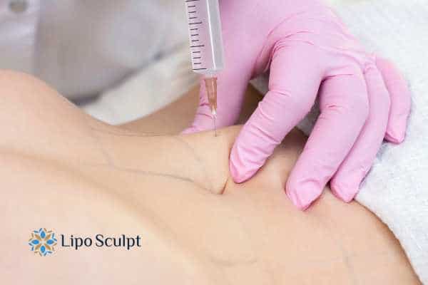 Aqualyx for Muffin Tops: What to Know Before Fat-Dissolving Injections 4 Are there risks Sunderland?