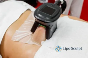 Does Fat Freezing At Home Work? 3 Fat freezing at home from Lipo Sculpt Sunderland